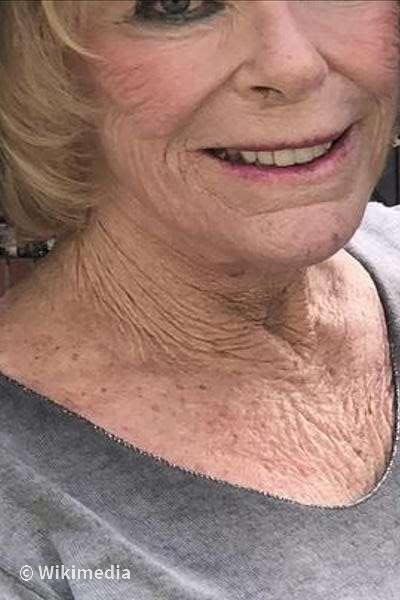 Elke Sommer Elke Sommer